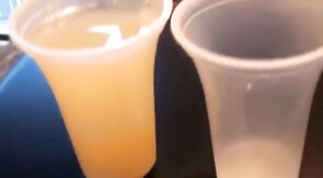 Sucking and Swallowing