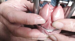 My Penis' Huge, Stretched Peehole