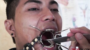 Asian patient anal licked while threeway breeded by doc