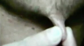 Elongated male nipples